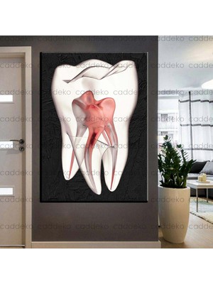 Caddeko Ağız ve Diş Sağlığı Polikliniği Tabloları Dekoratif Diş, Dekoratif Dişçi, Dişçi Dekorasyonu DSC-144
