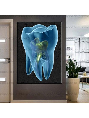 Caddeko Ağız ve Diş Sağlığı Polikliniği Tabloları Dekoratif Diş, Dekoratif Dişçi, Dişçi Dekorasyonu DSC-138