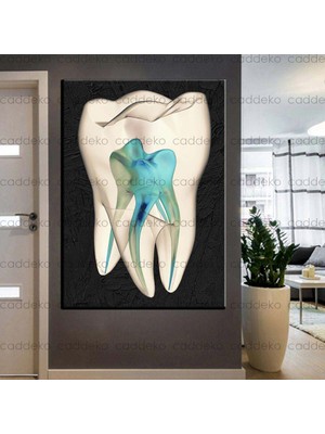 Caddeko Ağız ve Diş Sağlığı Polikliniği Tabloları Dekoratif Diş, Dekoratif Dişçi, Dişçi Dekorasyonu DSC-142
