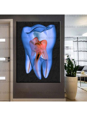 Caddeko Ağız ve Diş Sağlığı Polikliniği Tabloları Dekoratif Diş, Dekoratif Dişçi, Dişçi Dekorasyonu DSC-135
