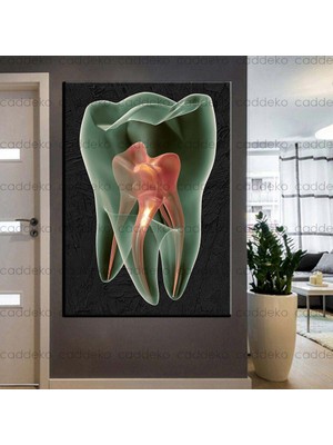 Caddeko Ağız ve Diş Sağlığı Polikliniği Tabloları Dekoratif Diş, Dekoratif Dişçi, Dişçi Dekorasyonu DSC-139