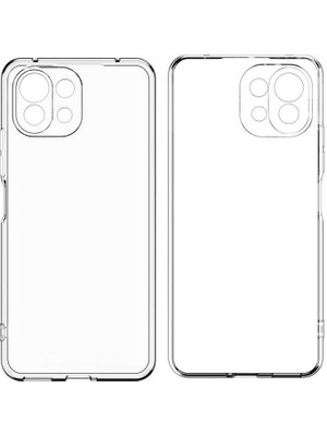 ZORE Xiaomi Mi 11 Kılıf Kamera Korumalı Süper Silikon Kapak - Renksiz