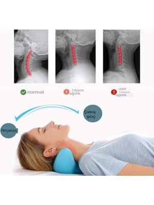 Mediterian Düz Traksiyon Cihazı Boyun Masaj Yastığı Düzeltici Kas Masaj Yastığı Servikal Boyun Düzeltme