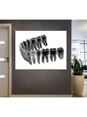 Limitless Design Ağız Ve Diş Sağlığı Polikliniği Tabloları Dekoratif Diş, Dekoratif Dişçi, Dişçi Dekorasyonu Dsc-159