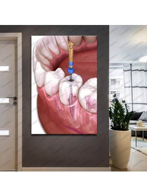 Limitless Design Ağız Ve Diş Sağlığı Polikliniği Tabloları Dekoratif Diş, Dekoratif Dişçi, Dişçi Dekorasyonu Dsc-163