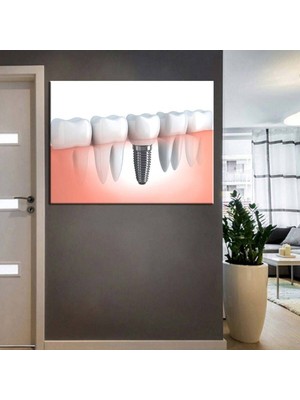 Limitless Design Ağız Ve Diş Sağlığı Polikliniği Tabloları Dekoratif Diş, Dekoratif Dişçi, Dişçi Dekorasyonu Dsc-57