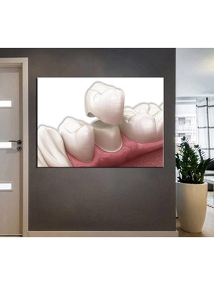 Limitless Design Ağız Ve Diş Sağlığı Polikliniği Tabloları Dekoratif Diş, Dekoratif Dişçi, Dişçi Dekorasyonu Dsc-162