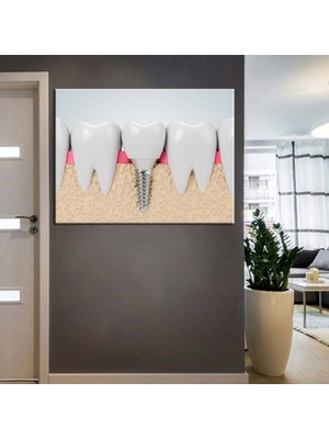 Limitless Design Ağız ve Diş Sağlığı Polikliniği Tabloları Dekoratif Diş, Dekoratif Dişçi, Dişçi Dekorasyonu Dsc-53