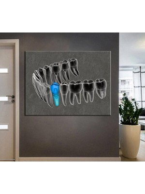 Limitless Design Ağız ve Diş Sağlığı Polikliniği Tabloları Dekoratif Diş, Dekoratif Dişçi, Dişçi Dekorasyonu