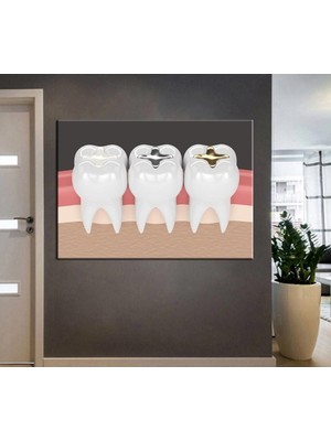 Limitless Design Ağız ve Diş Sağlığı Polikliniği Tabloları Dekoratif Diş, Dekoratif Dişçi, Dişçi Dekorasyonu DSC-161
