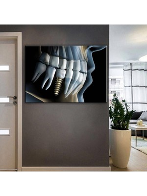 Tosbart Ağız Ve Diş Sağlığı Polikliniği Tabloları Dekoratif Diş, Dsc-35