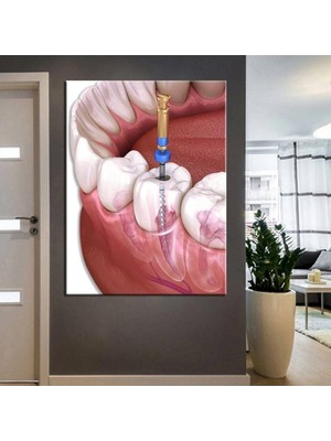 Tosbart Ağız Ve Diş Sağlığı Polikliniği Tabloları Dekoratif Diş,