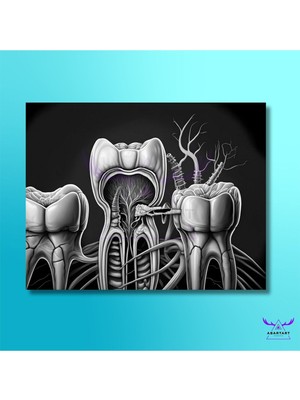 Abart Art Tekli Yatay Kanvas Diş Poliklinik Tablosu Kanal Tedavisi Tasarımı
