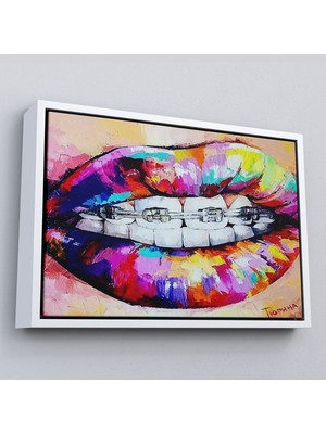 Çerçeveli Diş Teli ve Renkli Dudaklar Graffti TABLOSU-6651