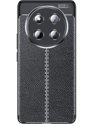 ZORE Honor Magic 7 Lite Kılıf Niss Silikon Kapak -116027