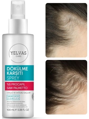 Yelvas Care Procapil 5% ve Saw Palmetto Saç Dökülmesine Karşı Güçlendirici Sprey (Serum) 100 ml