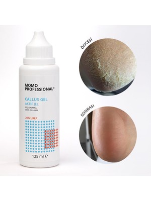 Momo Professional Callus Gel, Nasır Sökücü Keratolitik Pedikür Jel, 125 ml