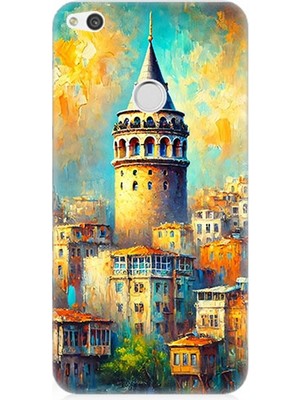 Huawei P9 Lite 2017 Uyumlu Galata’da Renkli Işıklar  Desenli Silikon Kılıf