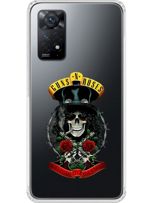 Dali Design Xiaomi Redmi Note 11 Pro Uyumlu Şeffaf Kılıf Guns N' Roses Tasarımlı