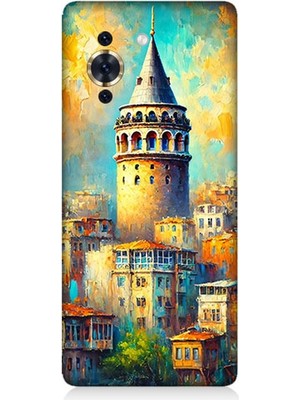 Huaweı Nova 10 Uyumlu Galata’da Renkli Işıklar  Desenli Silikon Kılıf