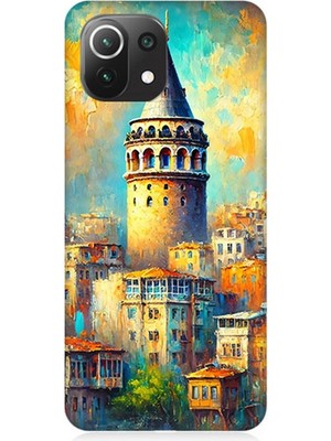 Xiaomi Mi 11 Lite Uyumlu Galata’da Renkli Işıklar  Desenli Silikon Kılıf