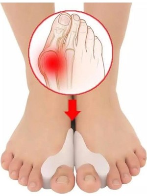 Sanal Trend 2 Çift Bay Bayan Parmak Arası Ayak Bunyon Kemik Koruyucu Silikon Makaralı Ayak Kemik Koruyucu