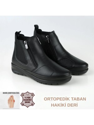 Tam Ortopedik Taban Hakiki Deri Kemik Çıkıntısı Anne Botu