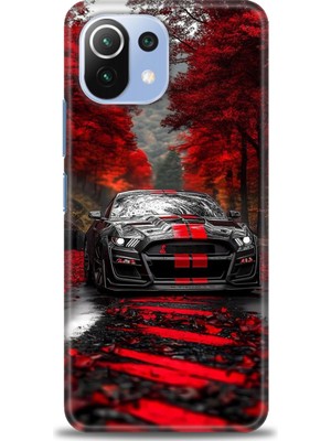 Xiaomi Mi 11 Lite Kılıf Hd Baskılı Kılıf + Seramik Tam Kaplayan Ekran Koruyucu 490