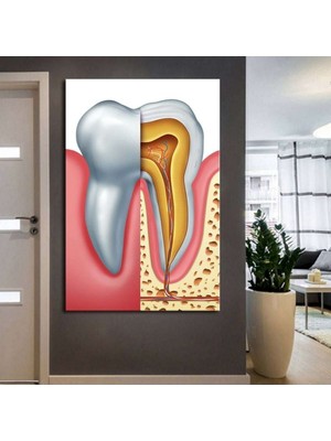 GülsenArt Ağız ve Diş Polikliniği, Dişçi Tabloları Dekoratif Diş Hd Dijital Dikey Baskı Kanvas Tablo