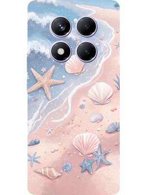 TechTree Redmi Note 14 Pro Plus 5g Uyumlu Sahil Deniz Kabuğu Baskılı Silikon Kılıf