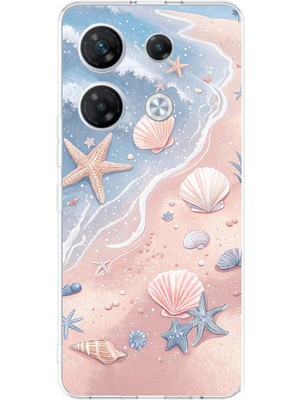 TechTree Infinix Gt 20 Pro Uyumlu Sahil Deniz Kabuğu Baskılı Silikon Kılıf