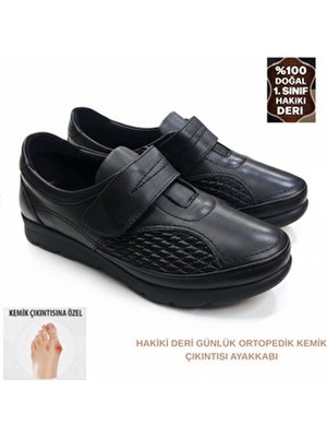 Shougo Tam Ortopedik Hakiki Deri Çift Taraflı Halluks Valgus Kemik Çıkıntısı Anne Ayakkabısı