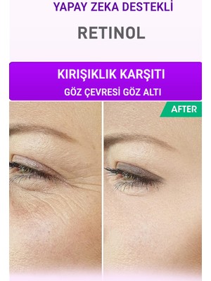 Devida Retinol Göz Çevresi Alın Çizgisi Kırışıklık Karşıtı Serum Xella Series A220
