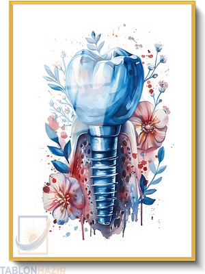 Tablonhazır Dikey Çerçeveli Cam Klinik Implant Modern Ev Dekoru Duvar Sanatı Ev Ofis Tablosu