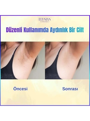 Storemax Elysian Essence Cilt Beyazlatıcı | Kararma Giderici Krem 3'lü Set - Genital Bölge, Koltuk Altı, Bikini Bölgesi, Dirsek ve Vücut 100 ml