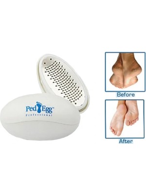 Ped Egg Topuk Törpüsü