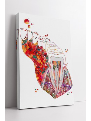 KOSS Dijital Renkli Diş Anatomi Sanatsal Tasarım Diş Kliniği Için Modern Dekoratif Kanvas Tablo