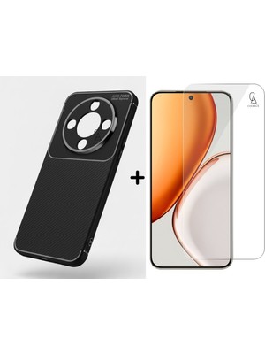Coolacs Honor Magic 8 Lite ile Uyumlu Karbon Tasarım Silikon Telefon Kılıfı ve Temperli Cam Ekran Koruyucu