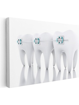 Tablofest Yatay Kanvas Tablo Sıralı Diş Modeli ve Teller Diş Hekimi Tablosu Ev Ofis Duvar Dekoru