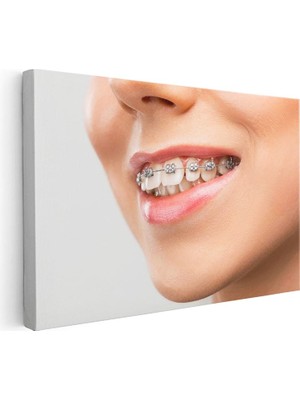 Tablofest Yatay Kanvas Tablo Metal Diş Teli ve Dudak Detayı Diş Hekimi Tablosu Ev Ofis Duvar Dekoru