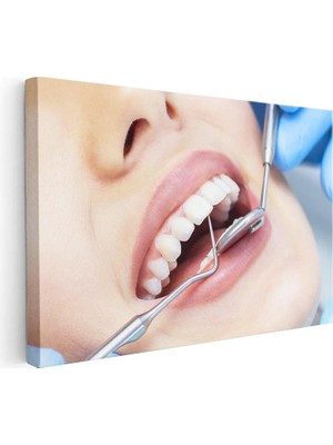 Tablofest Yatay Kanvas Tablo Metal Sond Ile Diş Muayene Detayı Diş Hekimi Tablosu Ev Ofis Duvar Dekoru