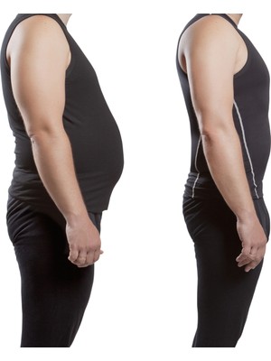 Miorre Erkek Göbek Korsesi