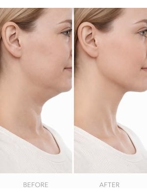 Skygo Lenfatik Drenaj Fırçası Yüz & Vücut Masaj Kuru Fırça Lenfatik Akış Stimülatörü Şişlik Azaltıcı Selülit Masaj Aracı Cilt Arındırıcı Şekillendirici Ergonomik Tasarım