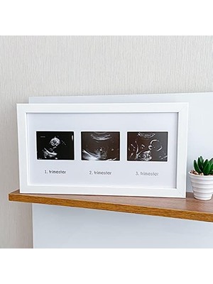 Aesco Üçlü Ultrason Anı Çerçevesi - Gebelikte Bebeğin Gelişimini Üç Trimester Anı Olarak Saklayın