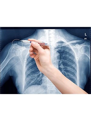 Renklimestore Edding – Roentgenmarker 8010 Beyaz