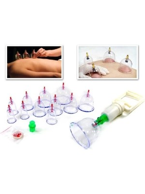 Mutlu Müşteri 12 Parça Vakumlu Hacamat Kup Çekme Seti