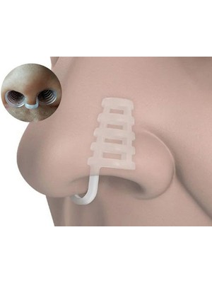 Akinco Horlama Burun Aparatı - Kafesli