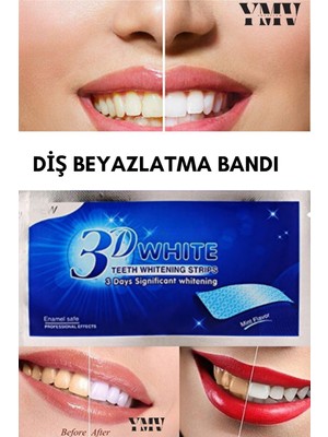 Özgürce 3D Beyazlatıcı Diş Bandı Çiftli, Hızlı ve Güzel Gülüş Için