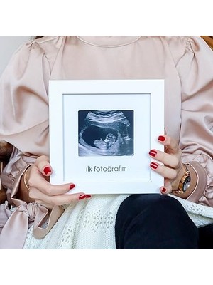 Misda Store Ilk Fotoğrafım Bebek Ultrason Çerçevesi - Bebek Odası Resim Anı Çerçevesi