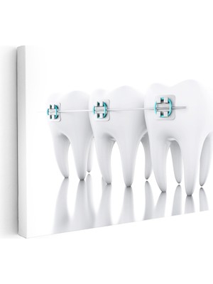 Kanvas Tablo Sıralı Diş Modeli ve Teller Diş Hekimi Tablosu Ev Ofis Duvar Dekoru